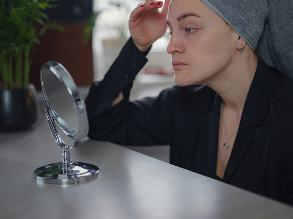 Conceptual shot of Acne and Problem Skin on female face.